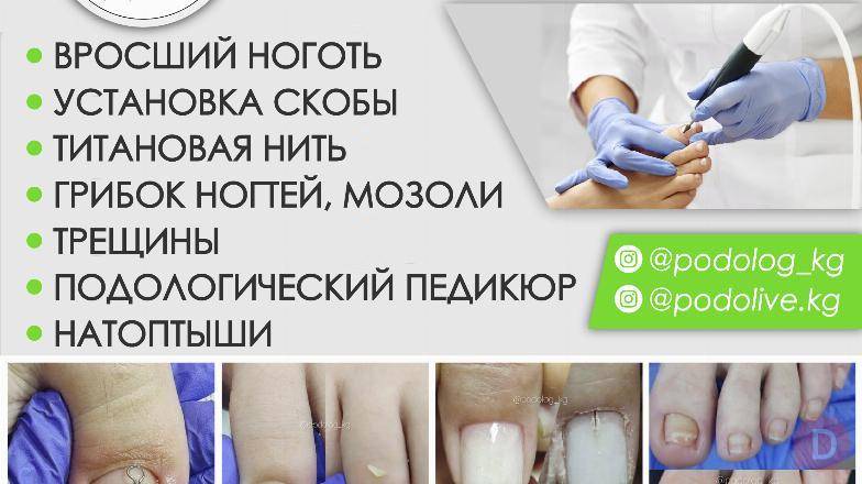 ПОДОЛОГ БИШКЕК Bishkek - изображение 1