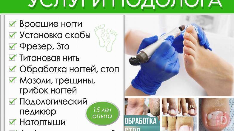 ПОДОЛОГ , Услуги Подолога Бишкек - изображение 1