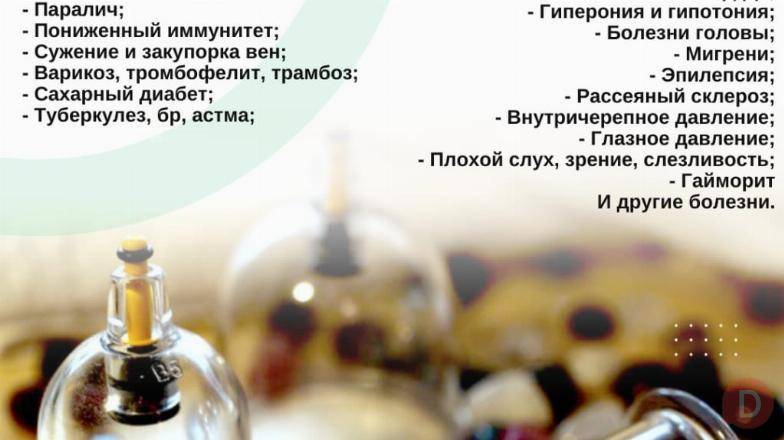 Хиджама в Бишкеке Бишкек - изображение 1