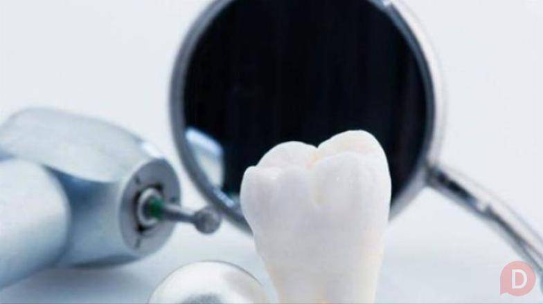 Услуги стоматологической клиники «Dream» Moscow - изображение 1