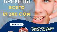 Брекеты! Только до 30 ноября, брекеты! всего 19200 сом