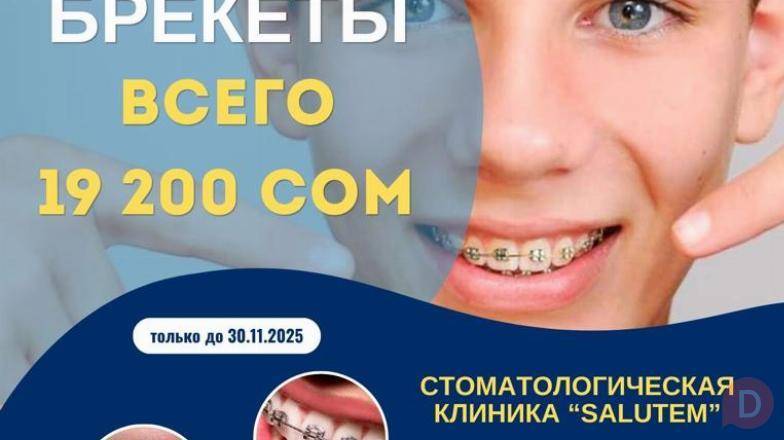 Брекеты! Только до 30 ноября, брекеты! всего 19200 сом Bishkek - изображение 1