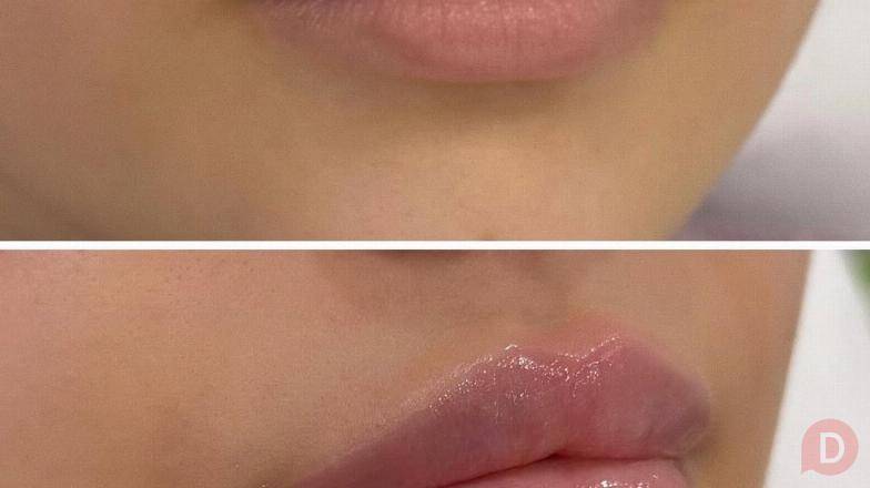 Красота начинается с заботы о себе! Костанай - изображение 1